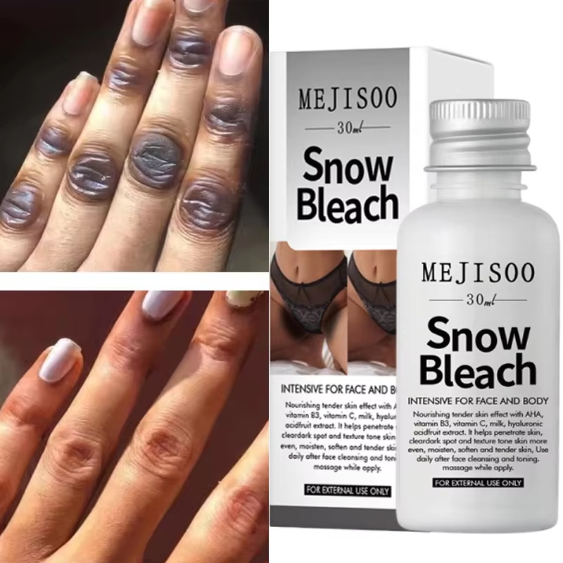 Fast Whitening Dark Knuckles B - Korean Skincare Routine recension och pris
