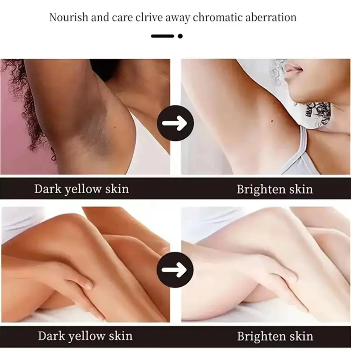Fast Whitening Dark Knuckles B - Korean Skincare Routine recension och pris