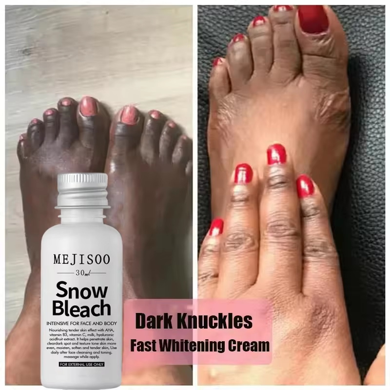 Fast Whitening Dark Knuckles B - Korean Skincare Routine recension och pris
